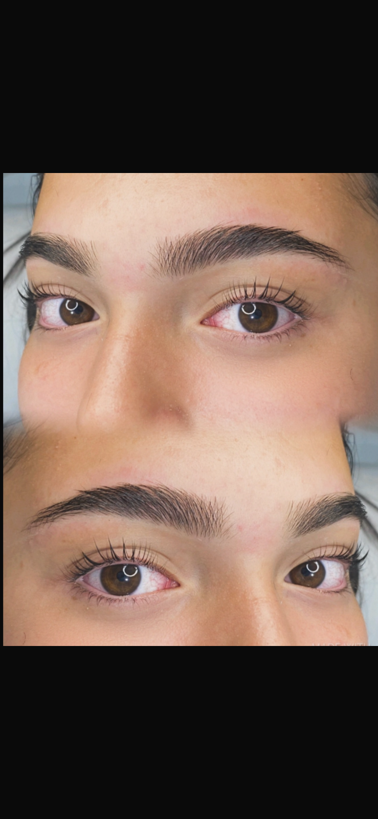 LASH Lifting